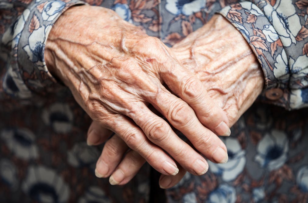 Elderly hands with parchment like skin are prone to skin tears and bumps and bruises. Limbkeepers gloves help to protect from damaging frail skin and thin skin especially in the elderly